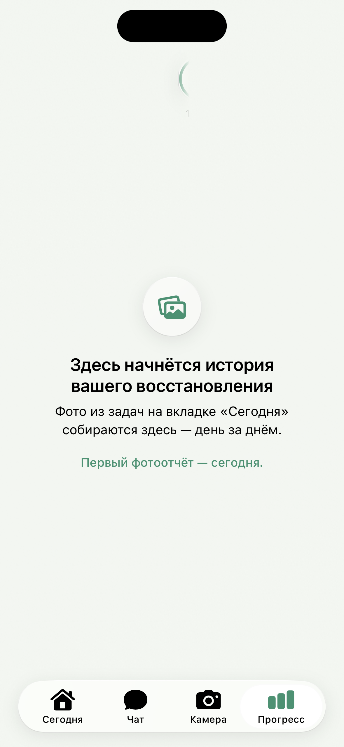 Actual Progress screen in Russian with no photos added: your recovery history starts here. Four app tabs appear at the bottom.